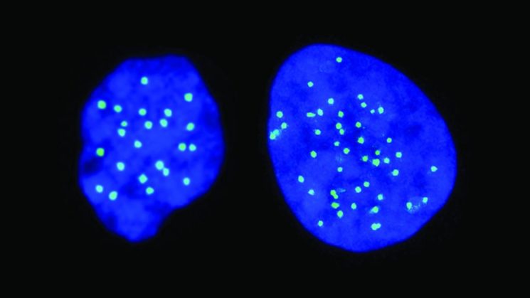 Eine haploide Zelle links, mit 23 Chromosomen; Eine diploide Zelle auf der rechten Seite, mit 46 Chromosomen. Foto zVg